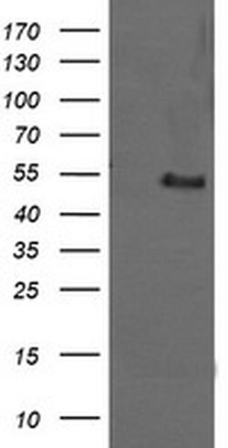 MDM4 Monoclonal Antibody (OTI2C9), TrueMAB , OriGene:Antibodies:Primary