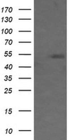 MDM4 Monoclonal Antibody (OTI2D11), TrueMAB , OriGene 100 &mu;L; Unconjugated:Antibodies,