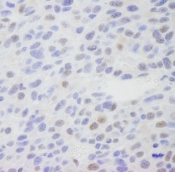 CRSP1/TRAP220 Polyclonal Antibody, Bethyl Laboratories 10 &mu;L; Unconjugated:Antibodies,