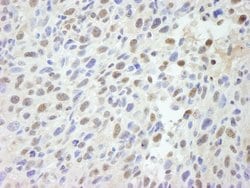 MED12 Polyclonal Antibody, Bethyl Laboratories 10 &mu;l; Unlabeled:Antibodies,