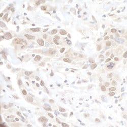 MED13L Rabbit anti-Human, Polyclonal, Bethyl Laboratories 100 &mu;L; Unconjugated:Antibodies,