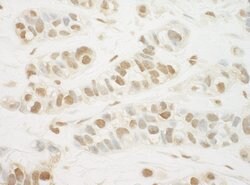 MED13L Polyclonal Antibody, Bethyl Laboratories:Antibodies:Primary Antibodies