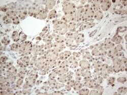 MED15 Monoclonal Antibody (OTI2C6), TrueMAB , OriGene:Antibodies:Primary