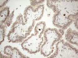 MED15 Monoclonal Antibody (OTI2C6), TrueMAB , OriGene 100 &mu;L; Unconjugated:Antibodies,