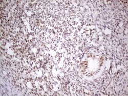 MED15 Monoclonal Antibody (OTI2C6), TrueMAB , OriGene 100 &mu;L; Unconjugated:Antibodies,