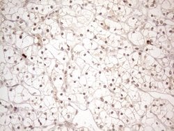 MED15 Monoclonal Antibody (OTI2C6), TrueMAB , OriGene 100 &mu;L; Unconjugated:Antibodies,