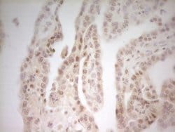 MED15 Monoclonal Antibody (OTI1D5), TrueMAB , OriGene 100 &mu;L; Unconjugated:Antibodies,