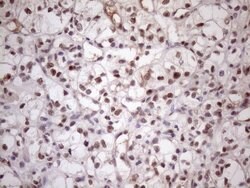 MED15 Monoclonal Antibody (OTI3F1), TrueMAB , OriGene:Antibodies:Primary