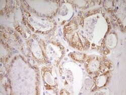 MED15 Monoclonal Antibody (OTI1H5), TrueMAB , OriGene 100 &mu;L; Unconjugated:Antibodies,