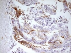 MED15 Monoclonal Antibody (OTI1H5), TrueMAB , OriGene:Antibodies:Primary