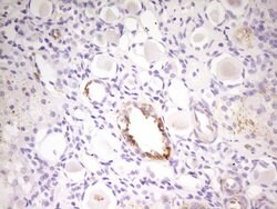 MED15 Monoclonal Antibody (OTI1H5), TrueMAB , OriGene 100 &mu;L; Unconjugated:Antibodies,