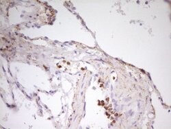 MED15 Monoclonal Antibody (OTI1H5), TrueMAB , OriGene 100 &mu;L; Unconjugated:Antibodies,