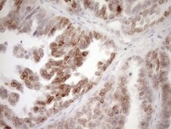 MED15 Monoclonal Antibody (OTI1C11), TrueMAB , OriGene 100 &mu;L; Unconjugated:Antibodies,