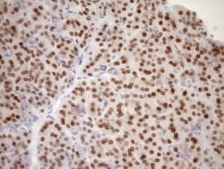 MED15 Monoclonal Antibody (OTI1C11), TrueMAB , OriGene 100 &mu;L; Unconjugated:Antibodies,