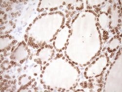 MED15 Monoclonal Antibody (OTI1C11), TrueMAB , OriGene 100 &mu;L; Unconjugated:Antibodies,