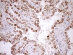 MED15 Monoclonal Antibody (OTI1C11), TrueMAB , OriGene 100 &mu;L; Unconjugated:Antibodies,