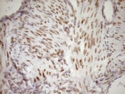 MED15 Monoclonal Antibody (OTI1C11), TrueMAB , OriGene 100 &mu;L; Unconjugated:Antibodies,