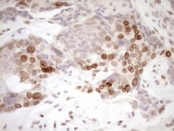 MED15 Monoclonal Antibody (OTI1C11), TrueMAB , OriGene 100 &mu;L; Unconjugated:Antibodies,