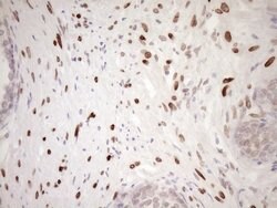 MED15 Monoclonal Antibody (OTI1C11), TrueMAB , OriGene 100 &mu;L; Unconjugated:Antibodies,