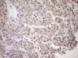 MED15 Monoclonal Antibody (OTI1C11), TrueMAB , OriGene 100 &mu;L; Unconjugated:Antibodies,