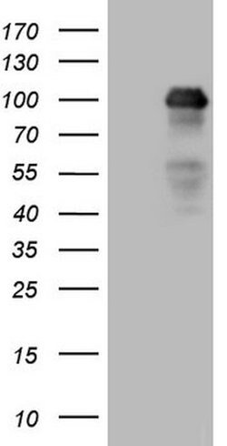 MED15 Mouse anti-Human, Clone: OTI2H6, lyophilized, TrueMAB 100 &mu;g;