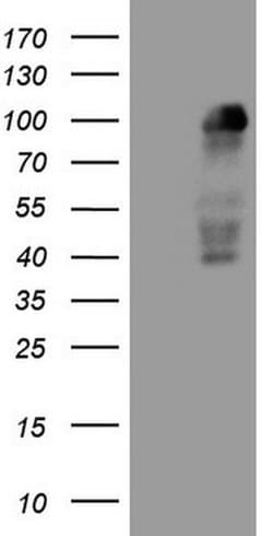 MED15 Monoclonal Antibody (OTI1D5), TrueMAB , OriGene 100 &mu;L; Unconjugated:Antibodies,