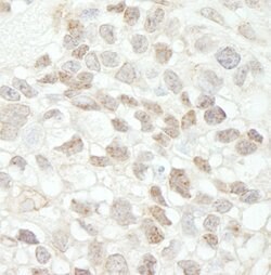 MED18 Rabbit anti-Human, Mouse, Polyclonal, Bethyl Laboratories 100 &mu;l;