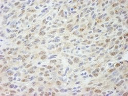 MED18 Polyclonal Antibody, Bethyl Laboratories 100 &mu;L; Unconjugated:Antibodies,