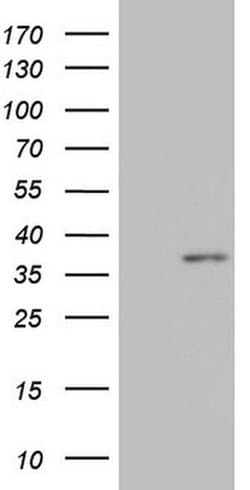 MED6 Monoclonal Antibody (OTI3C9), TrueMAB , OriGene 100 &mu;L; Unconjugated:Antibodies,