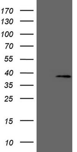 MED6 Monoclonal Antibody (OTI3B9), TrueMAB , OriGene 100 &mu;L; Unconjugated:Antibodies,