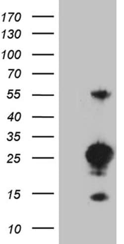 MED9 Monoclonal Antibody (OTI4G9), TrueMAB , OriGene 30 &mu;L | Buy Online | Origene Technologies | Fisher Scientific