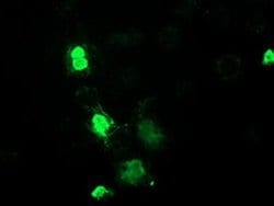 MEF2C Monoclonal Antibody (OTI2D2), TrueMAB , OriGene 100 &mu;L; Unconjugated:Antibodies,