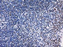 MEF2C Monoclonal Antibody (OTI2D2), TrueMAB , OriGene 100 &mu;L; Unconjugated:Antibodies,