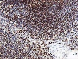 MEF2C Monoclonal Antibody (OTI2B12), TrueMAB , OriGene 100 &mu;L; Unconjugated:Antibodies,