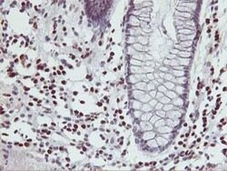 MEF2C Monoclonal Antibody (OTI2B12), TrueMAB , OriGene 100 &mu;L; Unconjugated:Antibodies,