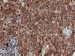 MEF2C Monoclonal Antibody (OTI2B12), TrueMAB , OriGene 100 &mu;L; Unconjugated:Antibodies,