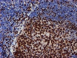 MEF2C Monoclonal Antibody (OTI4G8), TrueMAB , OriGene 100 &mu;L | Buy Online | Origene Technologies | Fisher Scientific