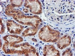 MEF2C Monoclonal Antibody (OTI4G8), TrueMAB , OriGene 100 &mu;L | Buy Online | Origene Technologies | Fisher Scientific