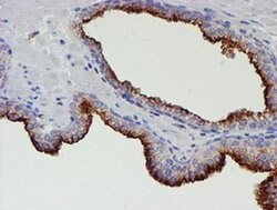 MEF2C Monoclonal Antibody (OTI2F2), TrueMAB , OriGene 100 &mu;L; Unconjugated:Antibodies,