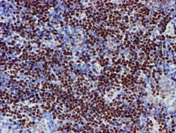 MEF2C Monoclonal Antibody (OTI2F2), TrueMAB , OriGene:Antibodies:Primary
