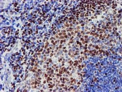 MEF2C Monoclonal Antibody (OTI2F2), TrueMAB , OriGene 100 &mu;L; Unconjugated:Antibodies,