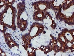 MEF2C Monoclonal Antibody (OTI2F2), TrueMAB , OriGene 100 &mu;L; Unconjugated:Antibodies,