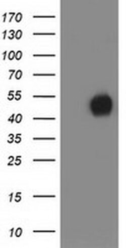 MEF2C Monoclonal Antibody (OTI2D2), TrueMAB , OriGene 100 &mu;L; Unconjugated:Antibodies,
