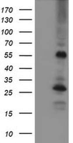 MEF2C Monoclonal Antibody (OTI1D1), TrueMAB , OriGene 100 &mu;L; Unconjugated:Antibodies,