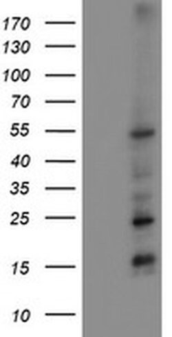 MEF2C Monoclonal Antibody (OTI2B12), TrueMAB , OriGene 100 &mu;L; Unconjugated:Antibodies,