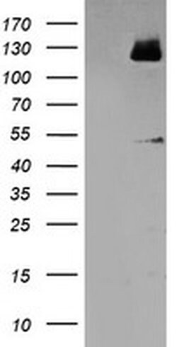 MEF2C Monoclonal Antibody (OTI2E2), TrueMAB , OriGene 100 &mu;L | Buy Online | Origene Technologies | Fisher Scientific
