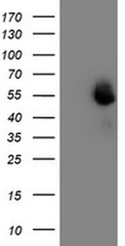 MEF2C Monoclonal Antibody (OTI4G8), TrueMAB , OriGene 100 &mu;L | Buy Online | Origene Technologies | Fisher Scientific