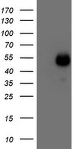 MEF2C Monoclonal Antibody (OTI2F2), TrueMAB , OriGene 100 &mu;L; Unconjugated:Antibodies,