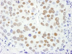 MEF2D Rabbit anti-Human, Mouse, Polyclonal, Bethyl Laboratories 100 &mu;L;