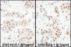 MEF2D Rabbit anti-Human, Mouse, Polyclonal, Bethyl Laboratories 100 &mu;L;